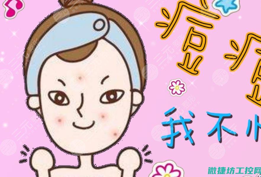 祛痘技术