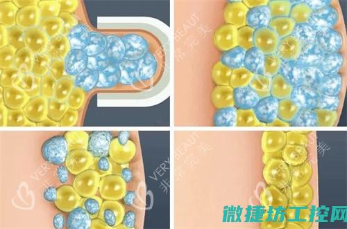 溶脂菜谱 (溶脂的效果怎么样)